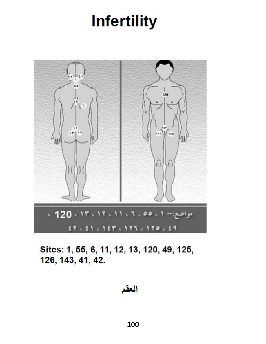 Hijama Atlas — page 100 — Low Testosterone