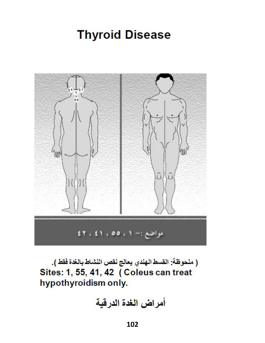 Hijama Atlas — page 102 — Hyperthyroidism