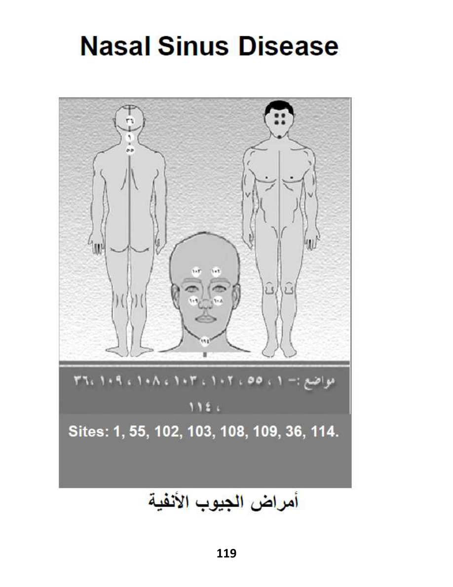 Hijama Atlas — page 119 — Sinusitis