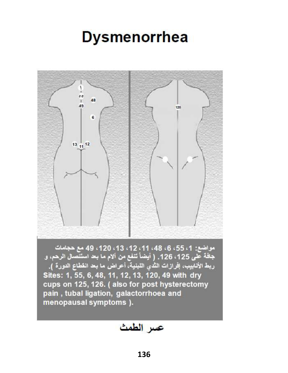 Hijama Atlas — page 136 — Uterine Fibroids (Supportive)