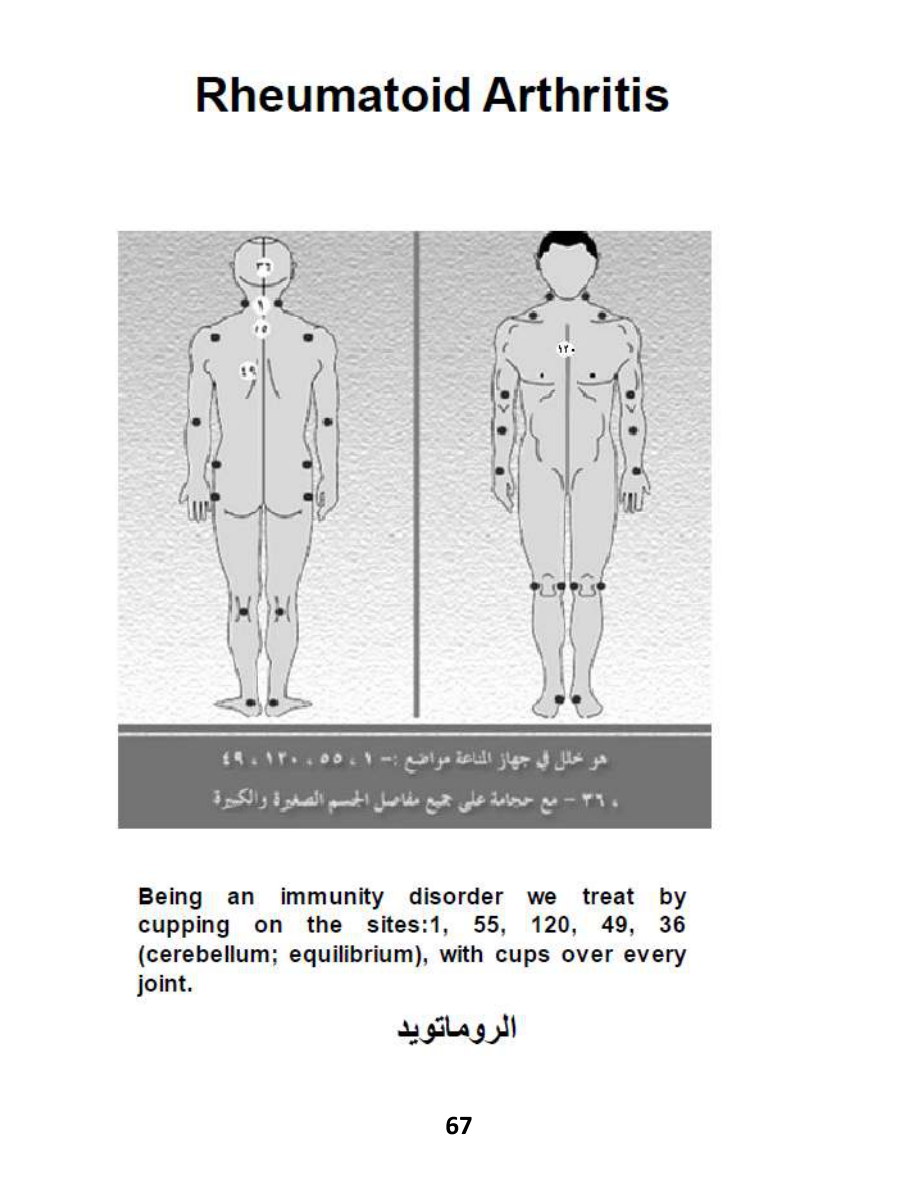 Hijama Atlas — page 67 — Lupus Supportive Care