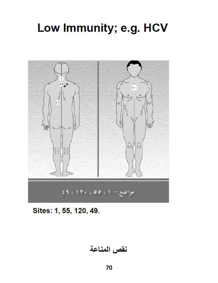 Hijama Atlas — page 70 — Al-Ayn (The Evil Eye)