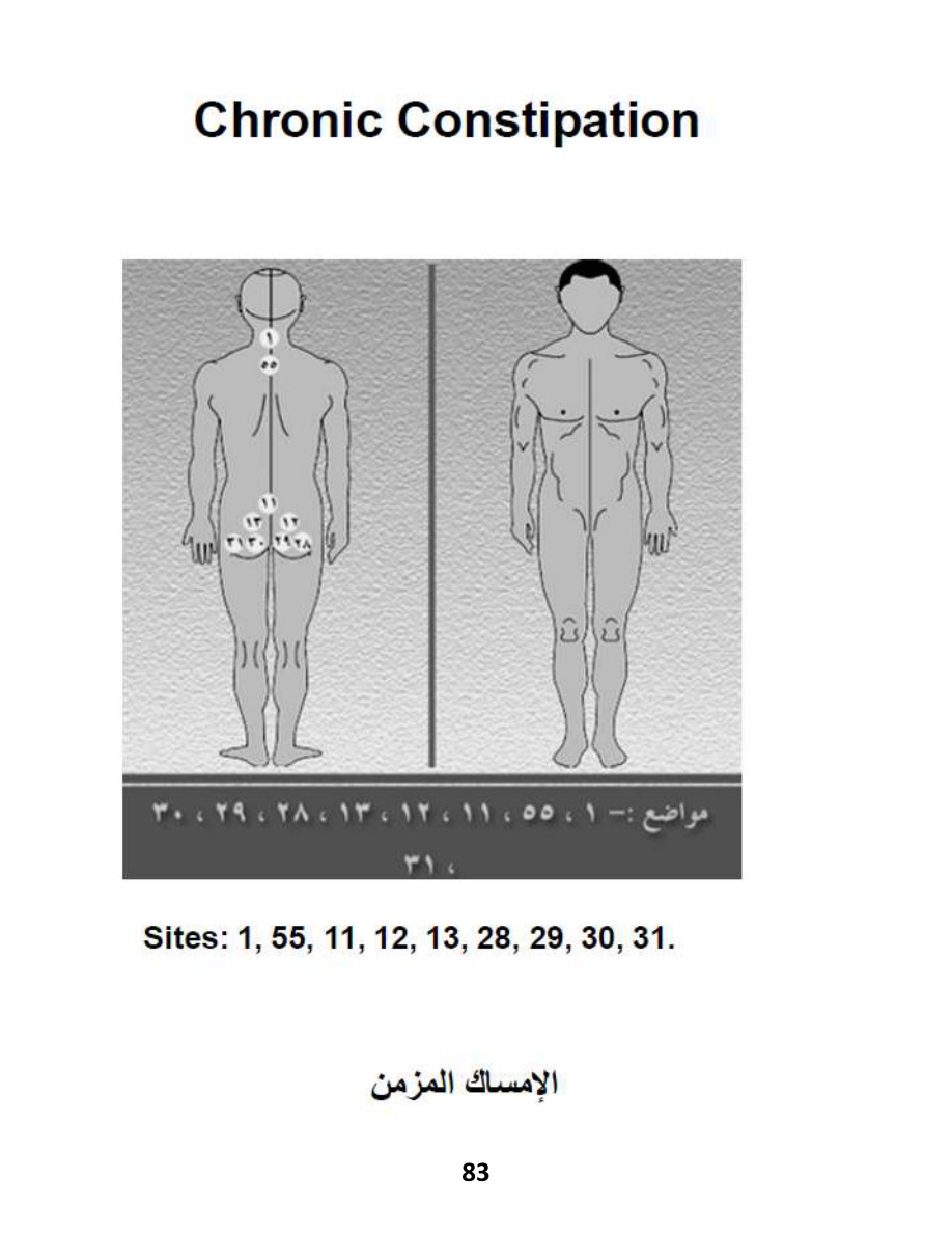 Hijama Atlas — page 83 — Chronic Constipation