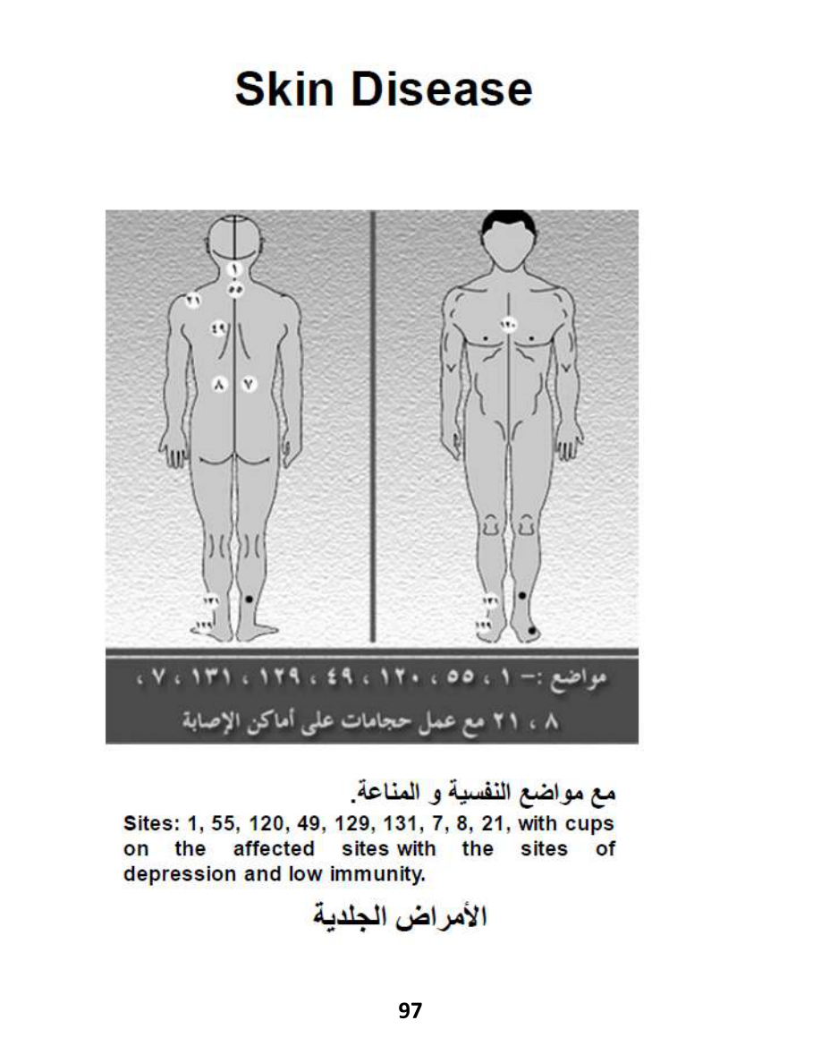 Hijama Atlas — page 97 — Psoriasis